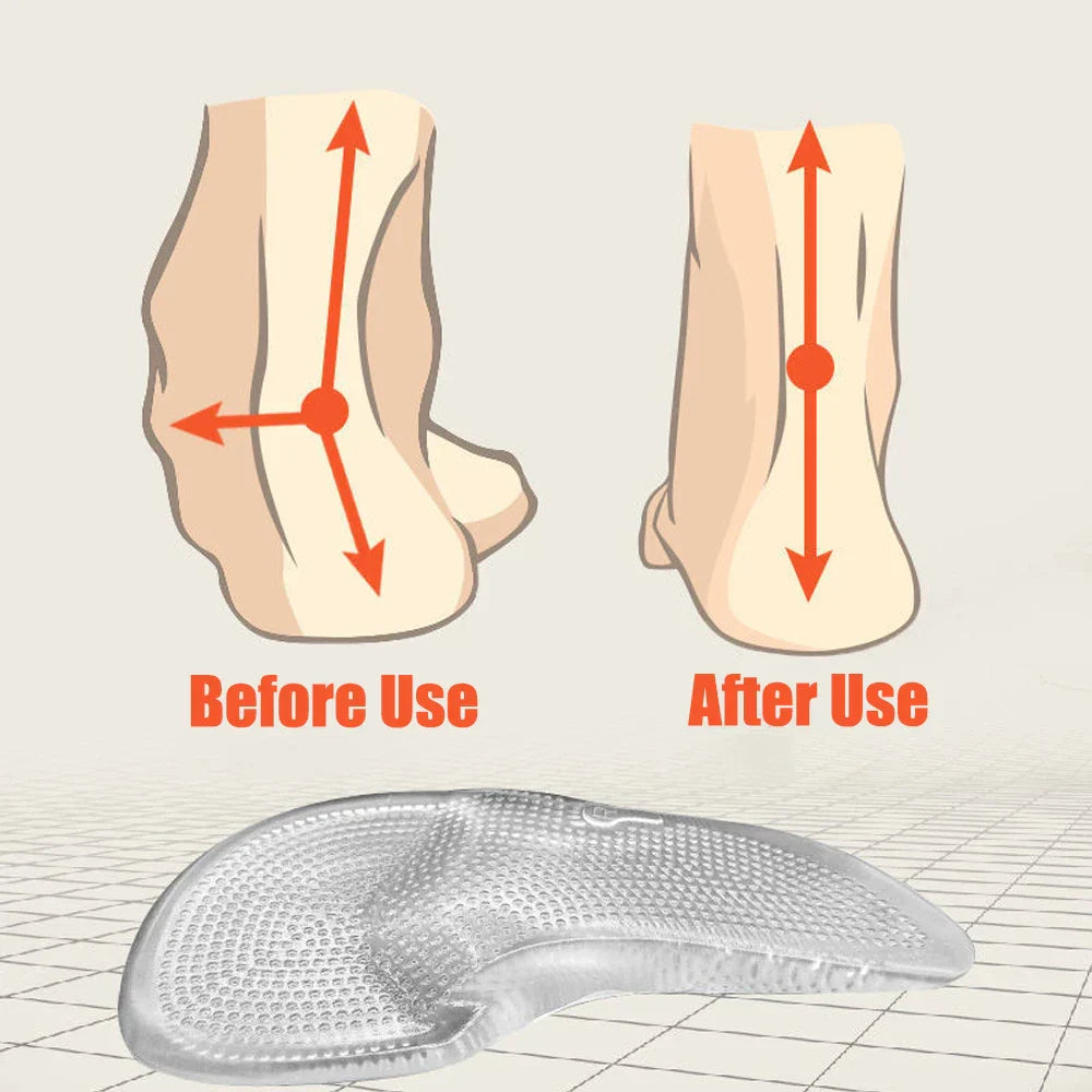 Komfortable orthopädische Silikongel-Einlegesohlen für Füße