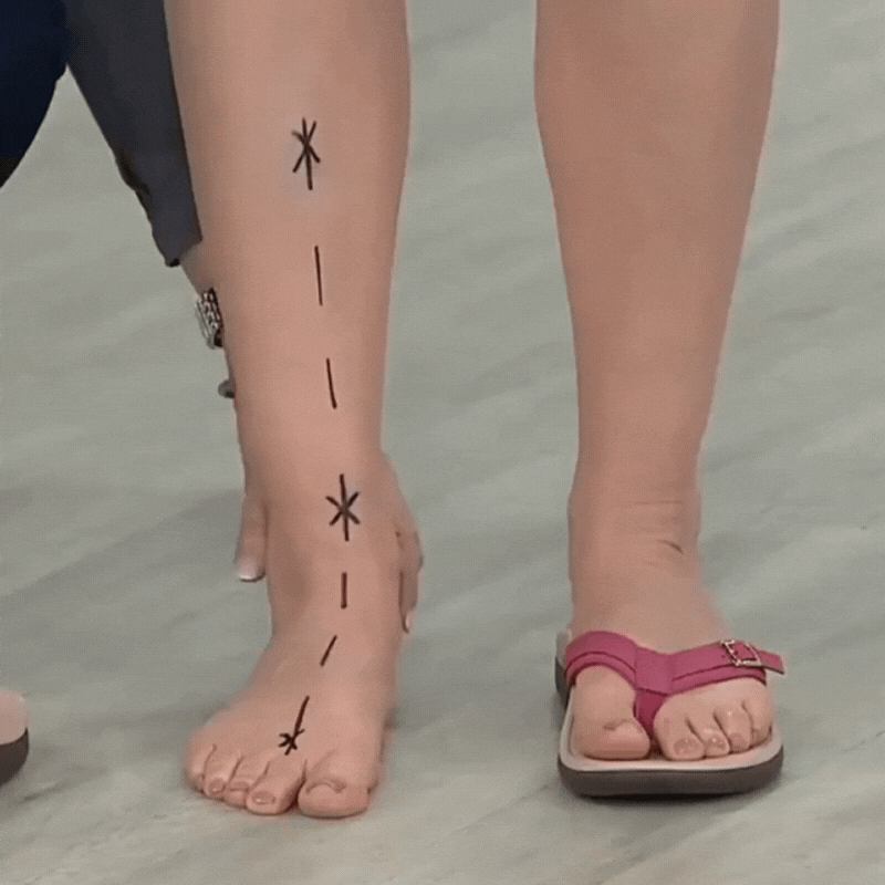 Orthopädische Damensandalen für Sommer Komfort und Unterstützung